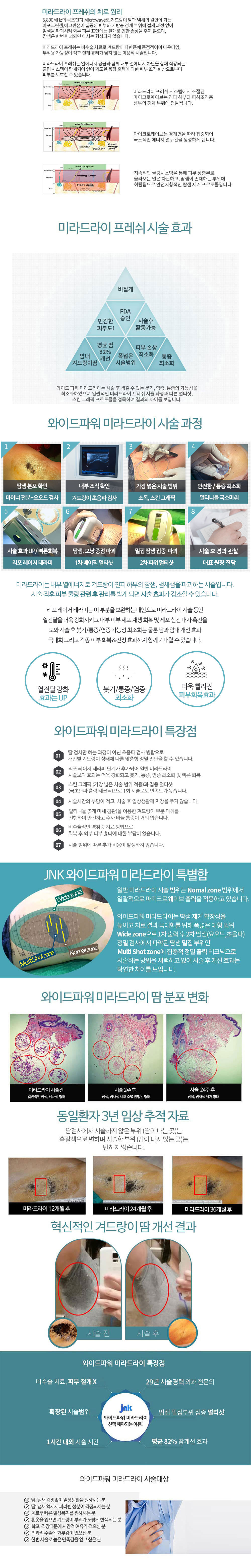 미라드라이시술